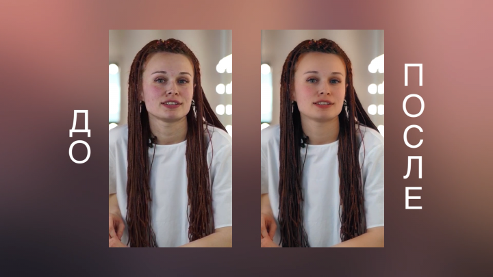 Уменьшений покраснений на коже лица