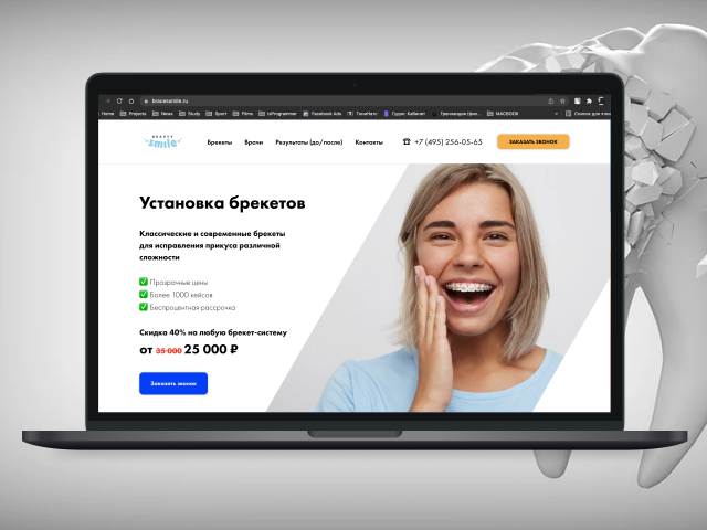 bracessmile.ru / Сайт для стоматологии "Beauty Smile" в Москве