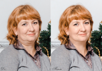 Убрать подбородок 1