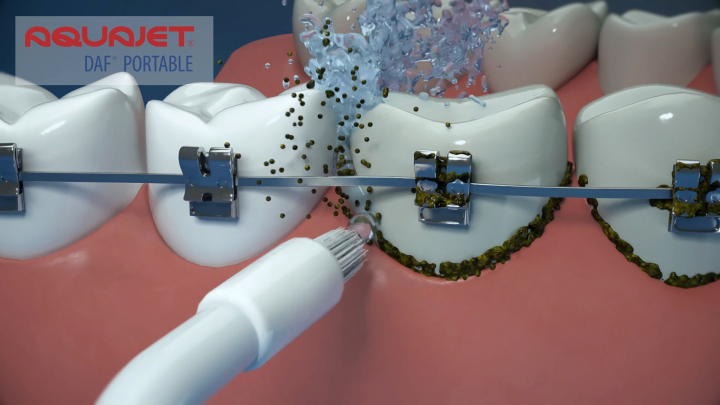 Irrigator animation 3D