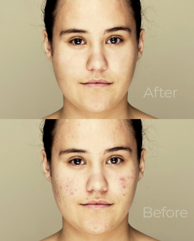 Ретушь лица