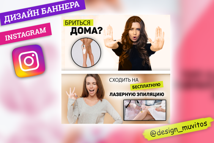 Эпиляция