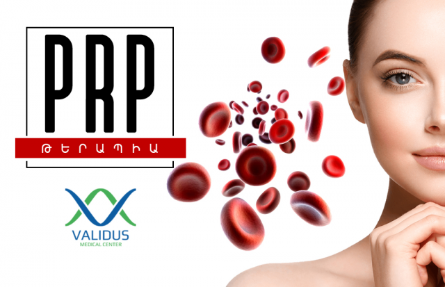 Работа 3474667