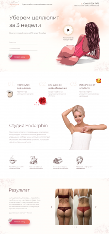 ENDORPHINE – Студия лечебного массажа