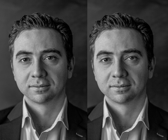 Коррекция положения глаз