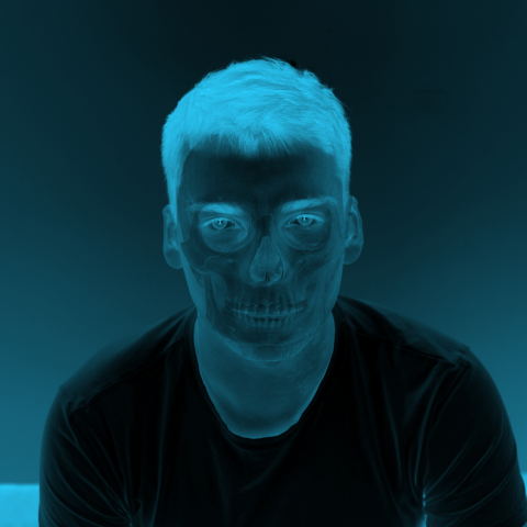 Рентген