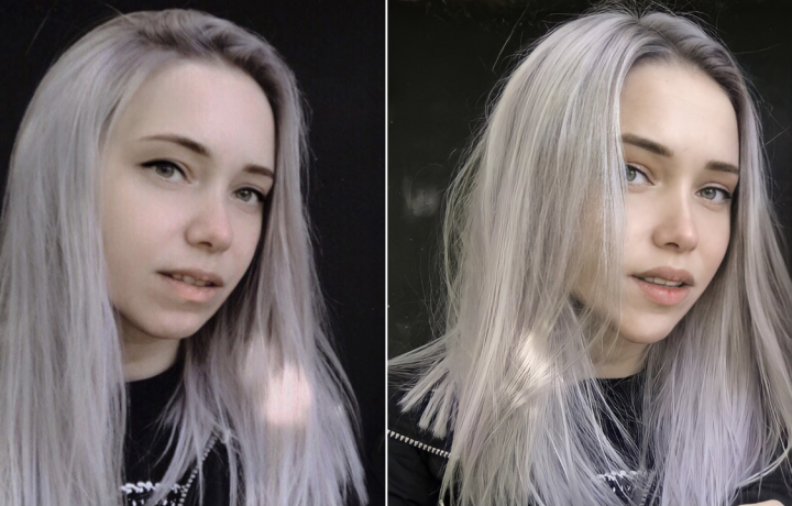 Ретушь и пластика лица