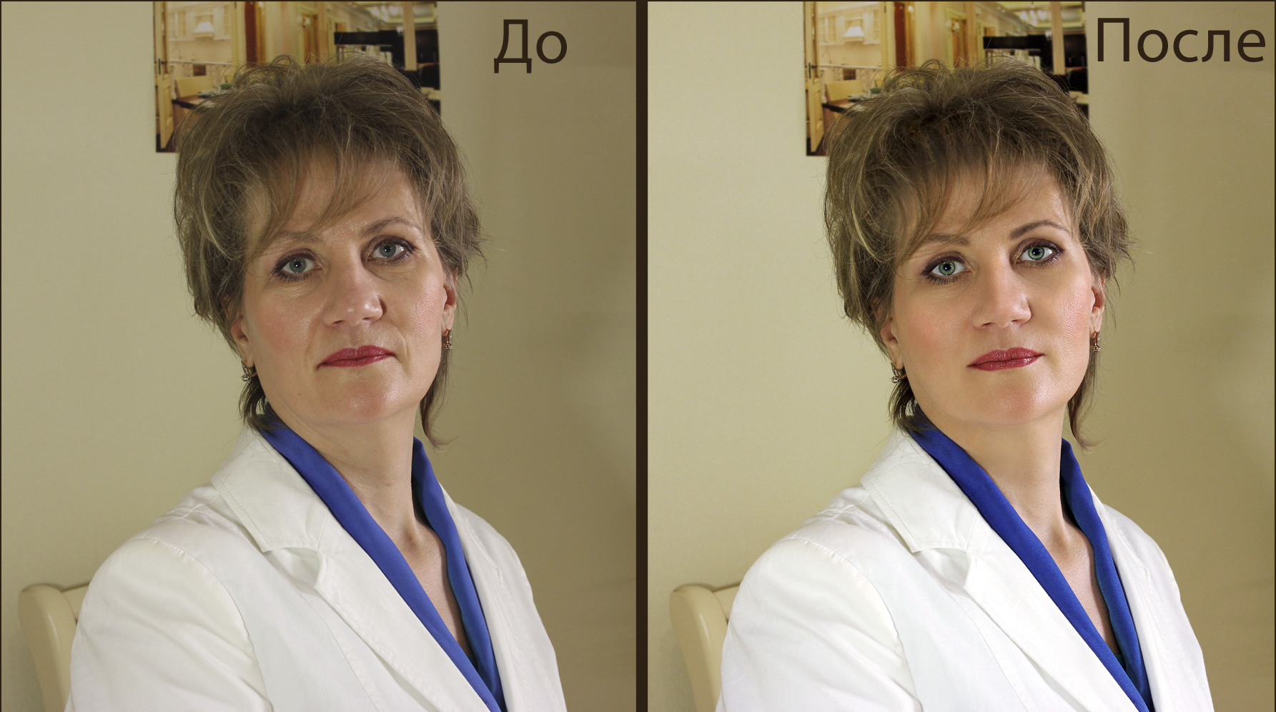 Жанна До и После.jpg