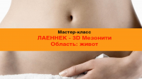 Лаеннек-3D Мезонити