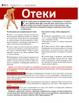 Отеки