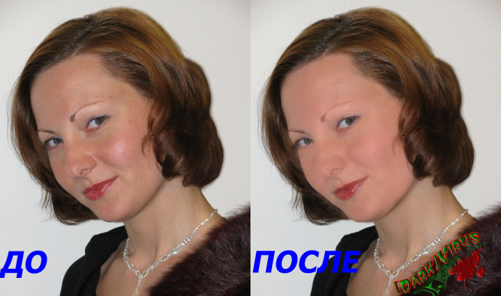 Ретушь/исправление дефектов лица