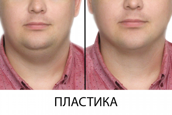 ретушь