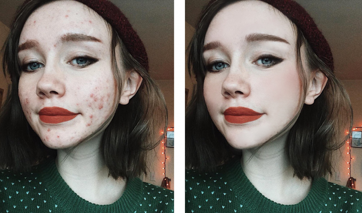 Ретушь кожи