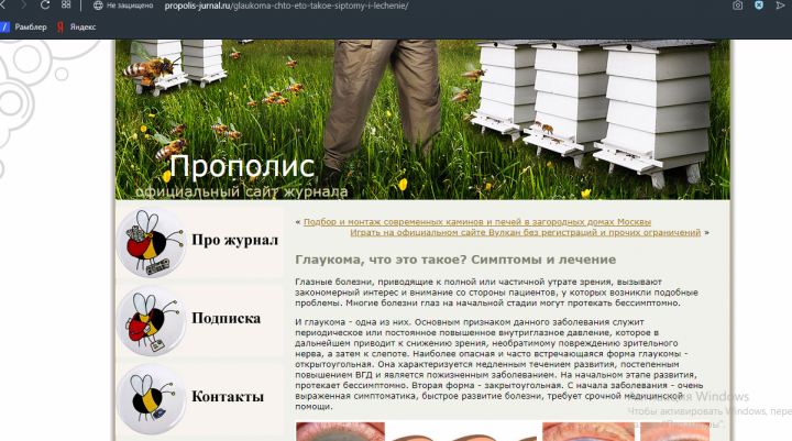 Глаукома. Что это такое? Симптомы и лечение