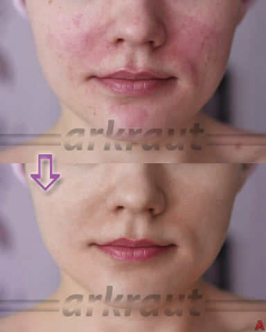 "Тренировочная" ретушь