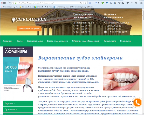 Выравнивание зубов элайнерами