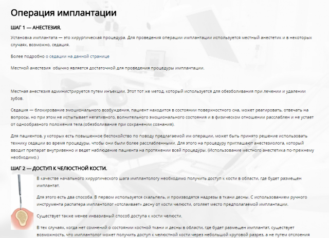 Статья на тему Имплантации зубов