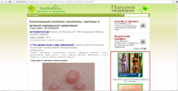 Контагиозный моллюск