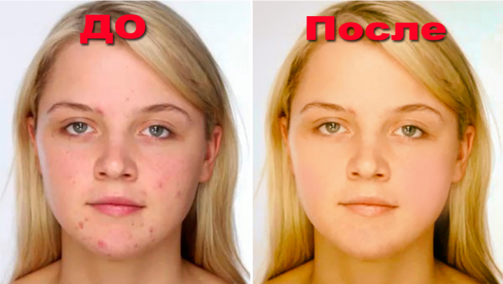 Ретуширование