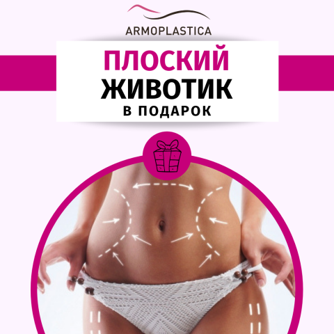 Армопластика