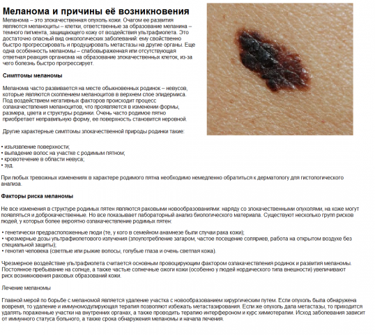 МЕЛАНОМА