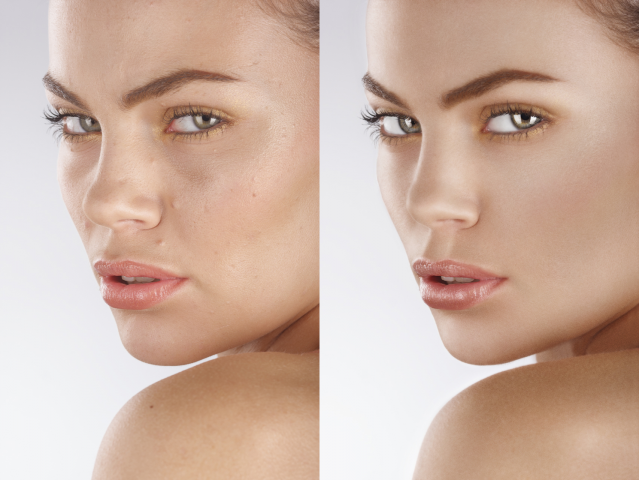 Beauty retouch