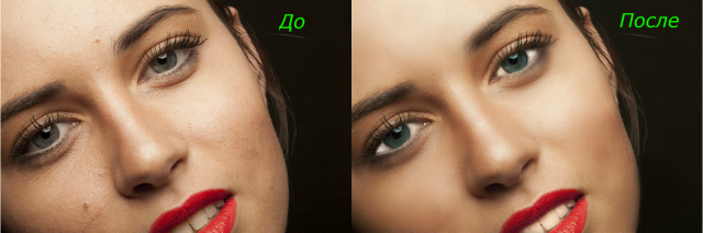 foto1