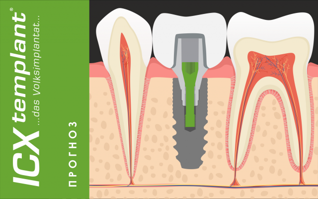 Иллюстрация для ICX