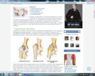 Лечение дисплазии тазобедренных суставов у детей