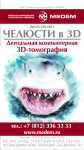челюсти в 3D