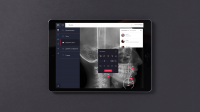 X-Ray Editor
