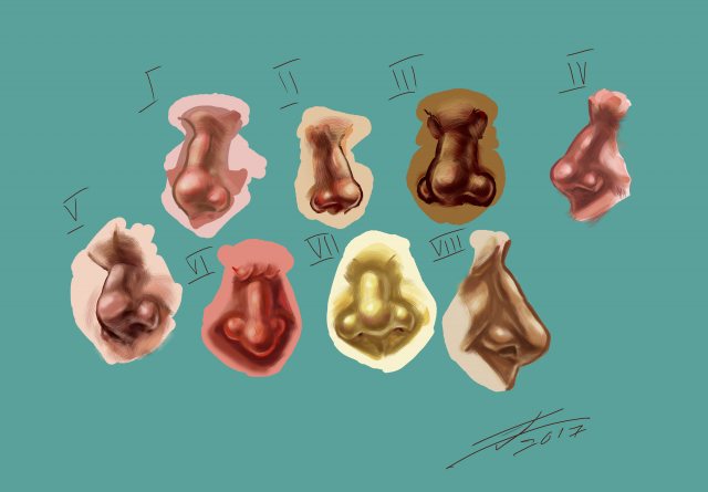 Noses