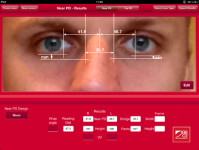 BBGR Measurement
