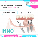 Implants.am