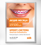 Стоматология "ZUB" – Брекет система
