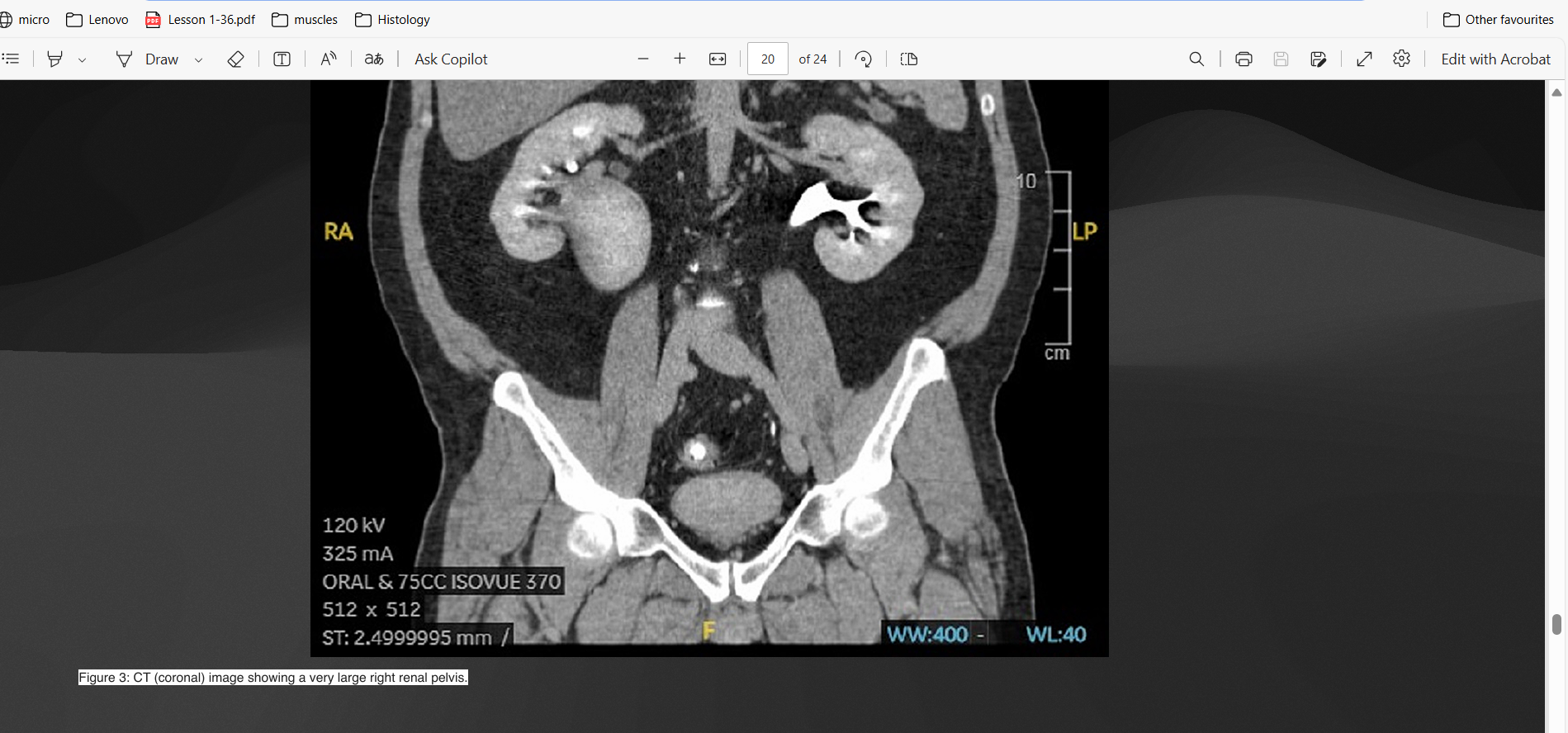 Screenshot 2025-02-15 215630.png