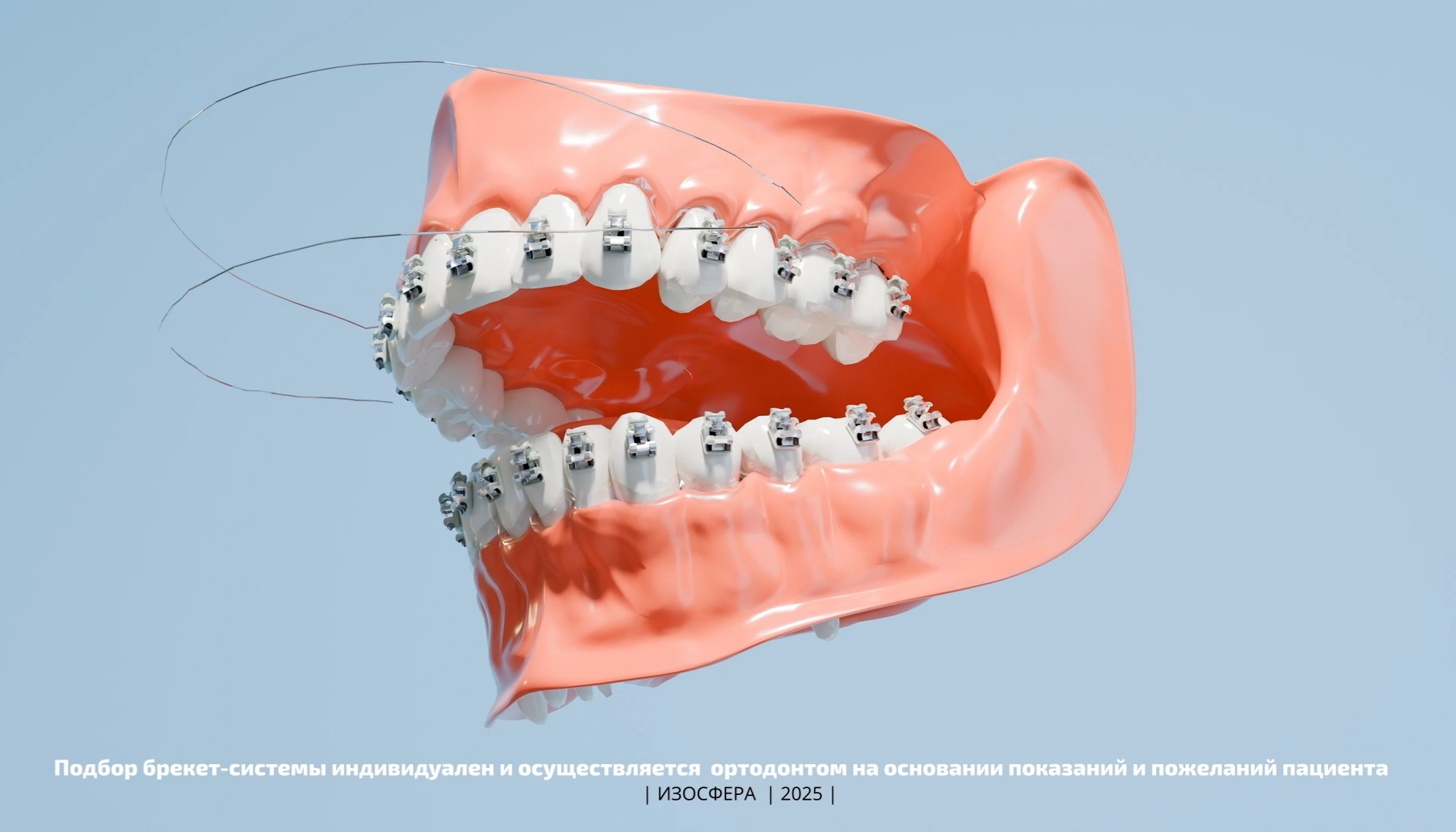 Screenshot_20250312-162546_Gallery.jpg
