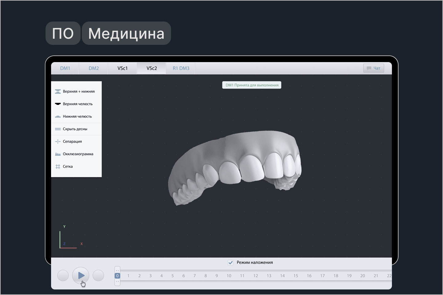 Eurokappa — веб-платформа для работы ортодонтов