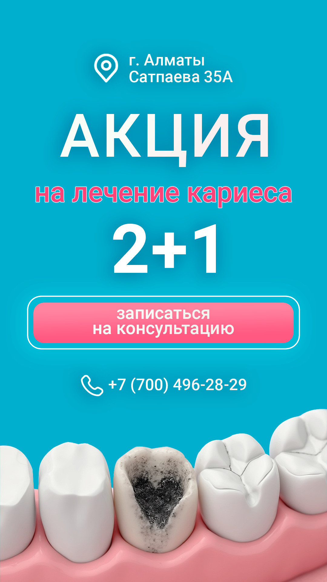 Кариес_9_16.png