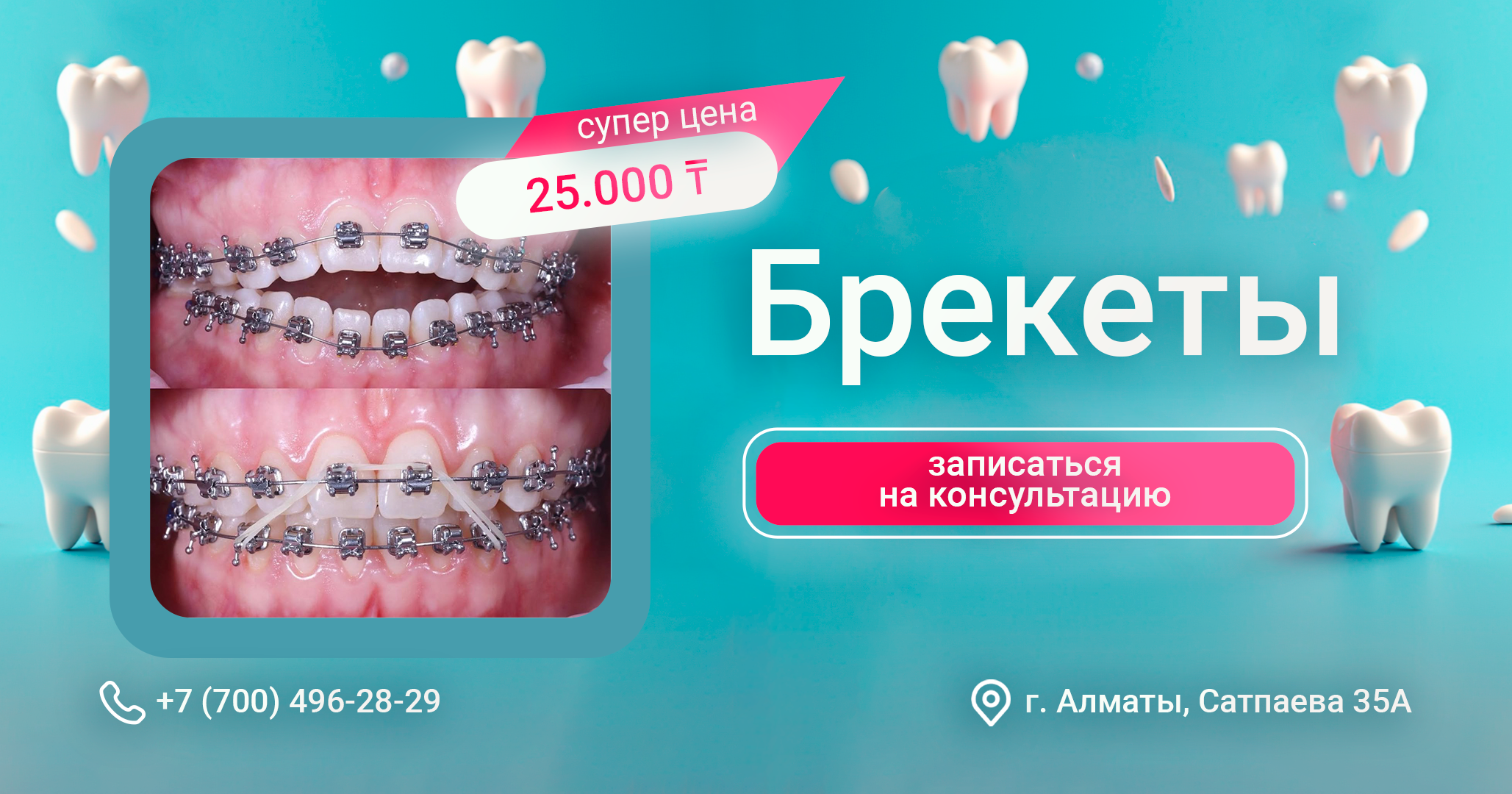 Брекеты_191_1.png