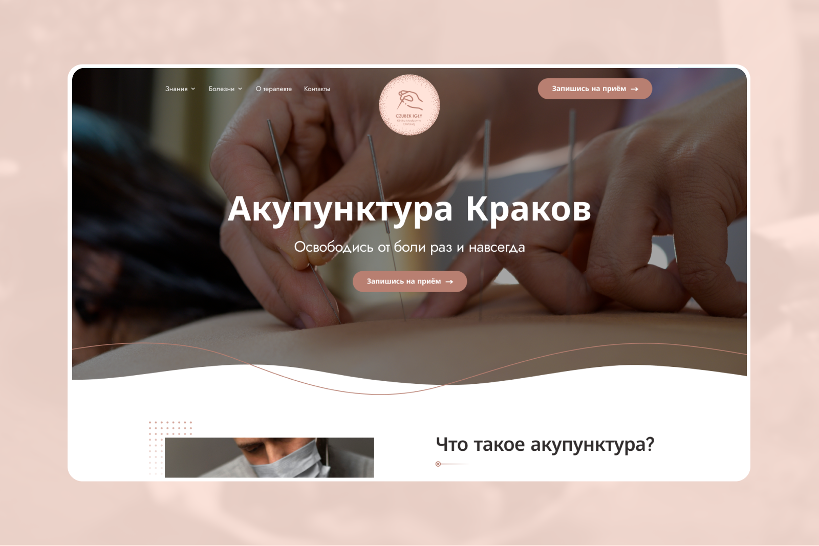 Центр акупунктуры