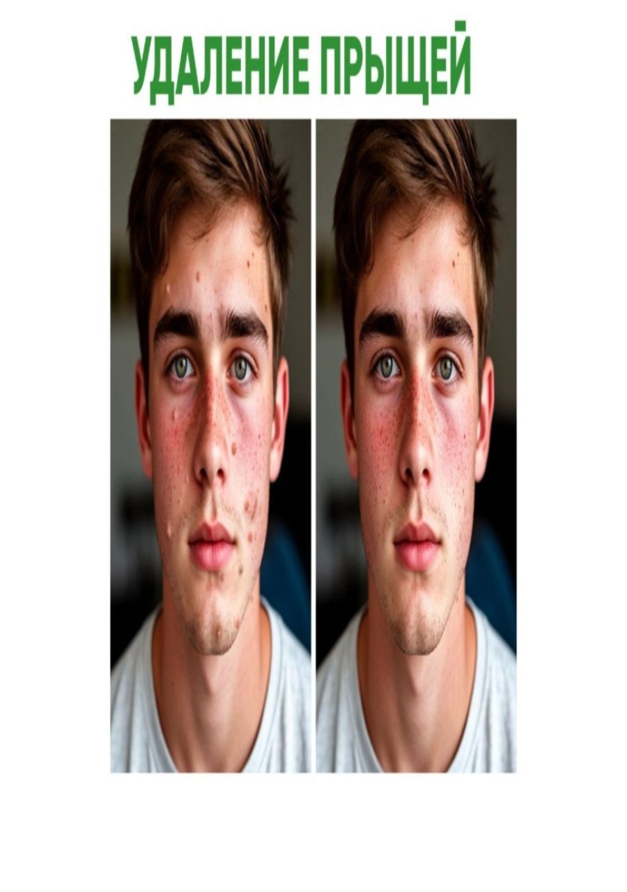 converted-image-increasejpg.com-удаление прыщей.jpeg