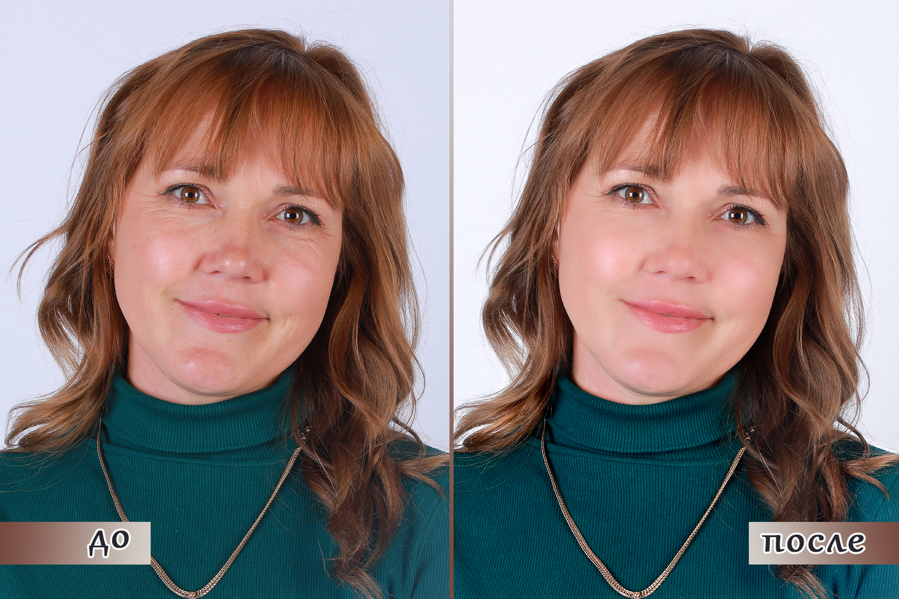 до после  .jpg