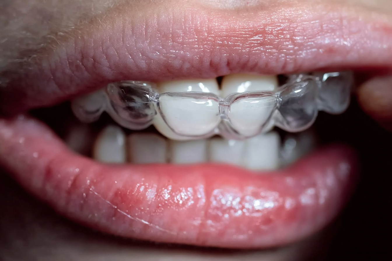 estaiez_httpss.mj.runROBNdWJKc_A_close-up_of_a_human_mouth_sl_6a