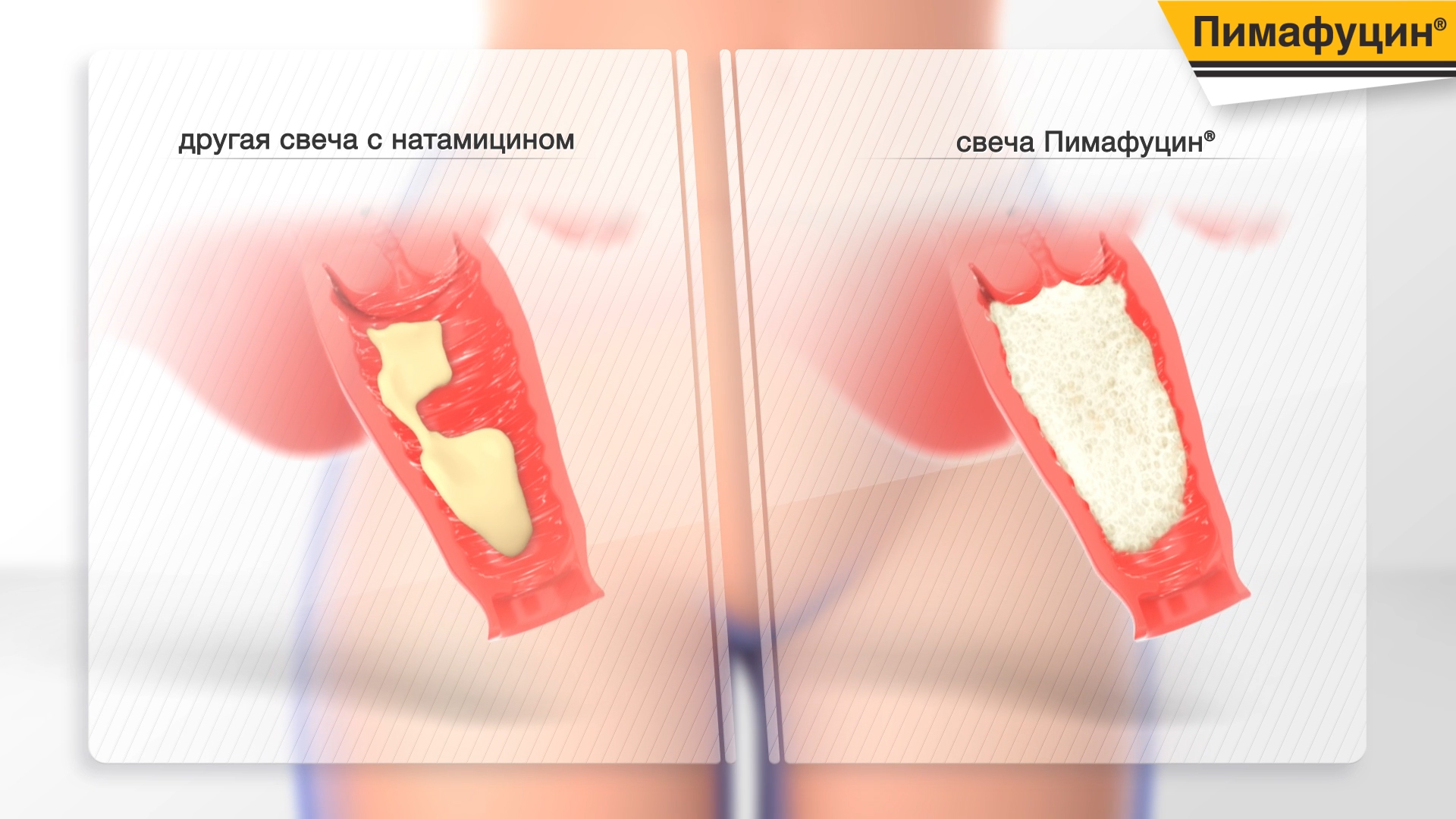 pimafucin (01033).jpg