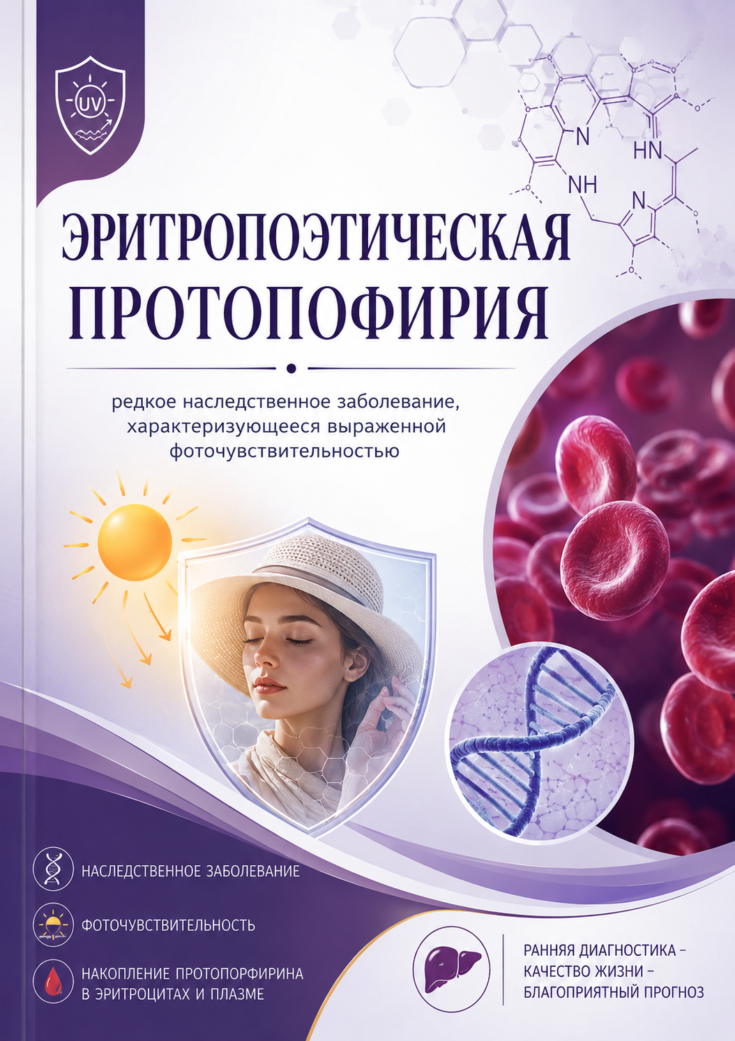 Эритропоэтическая протопорфирия