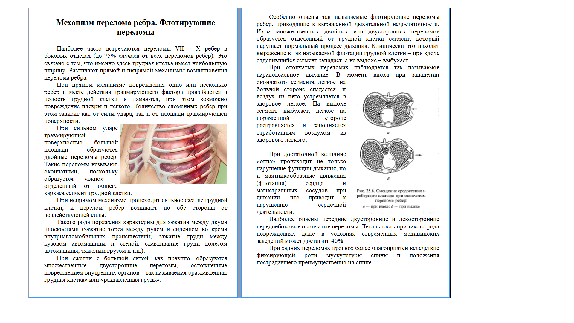 Перелом ребра (отрывок из статьи) - Фрилансер Оксана Чередник Vekla -  Портфолио - Работа #1273112