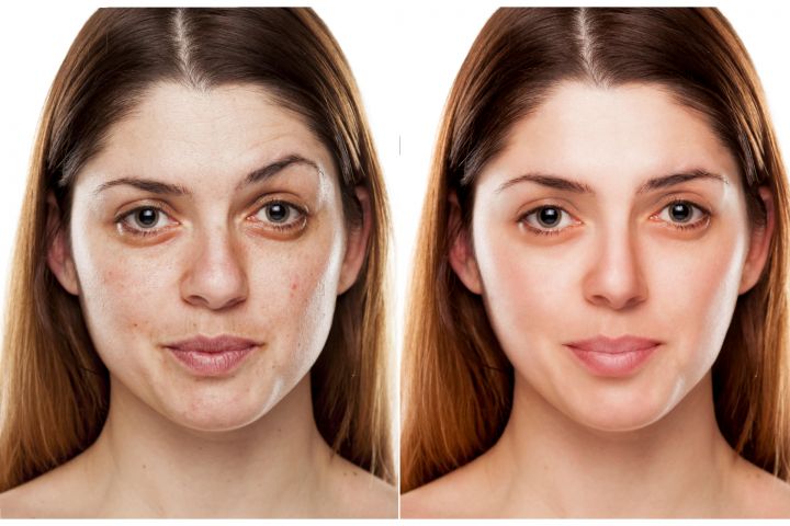 Ретушь фото / retouch photo - 1518007