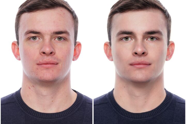 Ретушь портретной фотографии