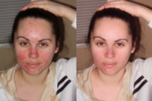 Ретушь лица